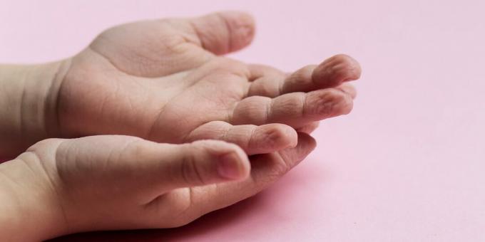 Kehareaktsioonid: naha kortsus sõrmedel