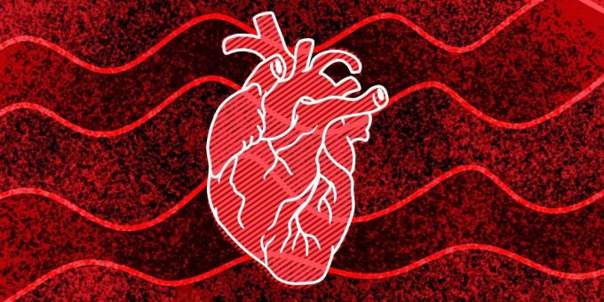 11 märke, mida võib juhtuda südame seiskumine