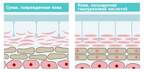 Kas hüaluroonhape taastab noorte
