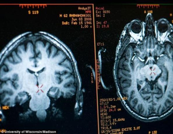 aju Mathieu Ricard pilt saadakse MRI