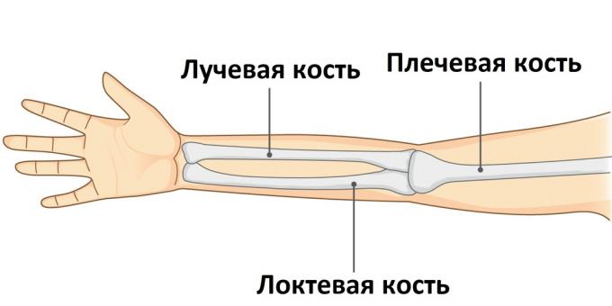 Kui käsi on katki, on üks selle kolmest luust vigastatud.