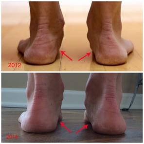 Kuidas käivitada minimalistlikus kingad muutus jalad