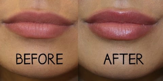 säästa kosmeetika: huule tugisüsteemide