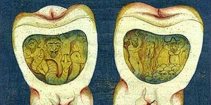 Keskaja meditsiin: lehekülg Ottomani hambaravist, 17. sajand.